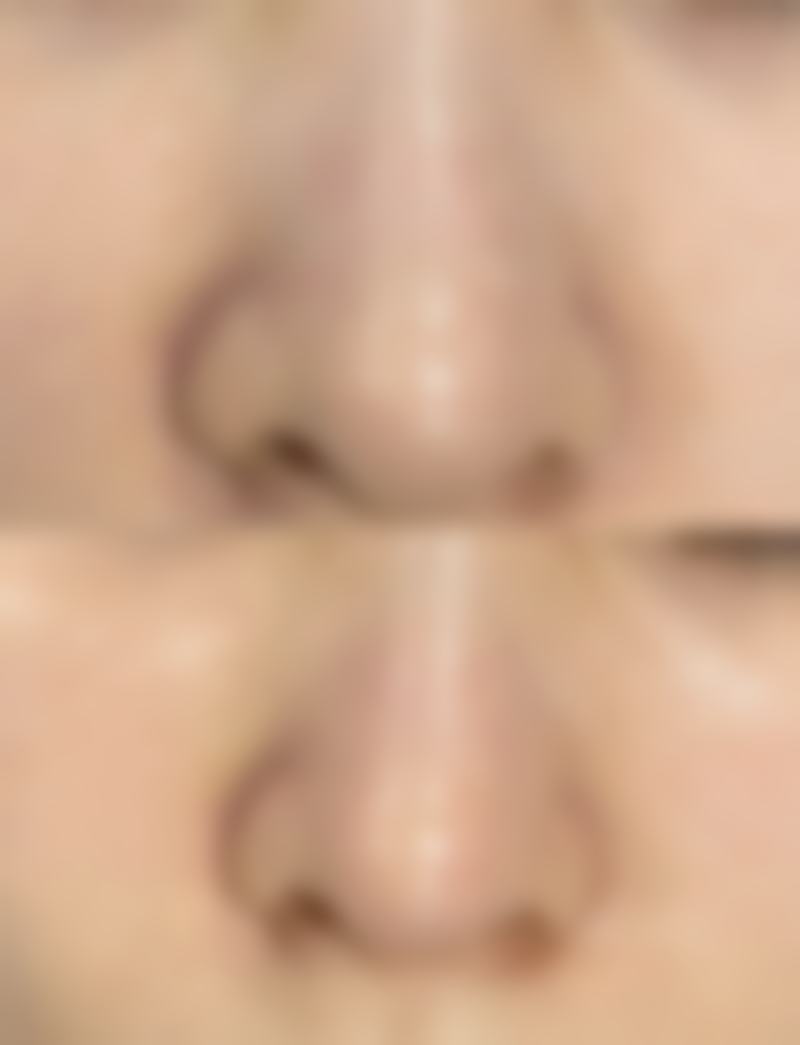 临沂爱美医疗美容门诊部真实实例