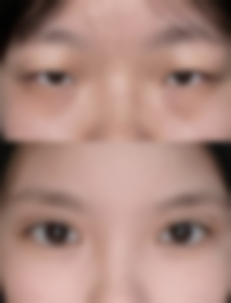 韩国AD爱慕整形外科医院预约挂号方式