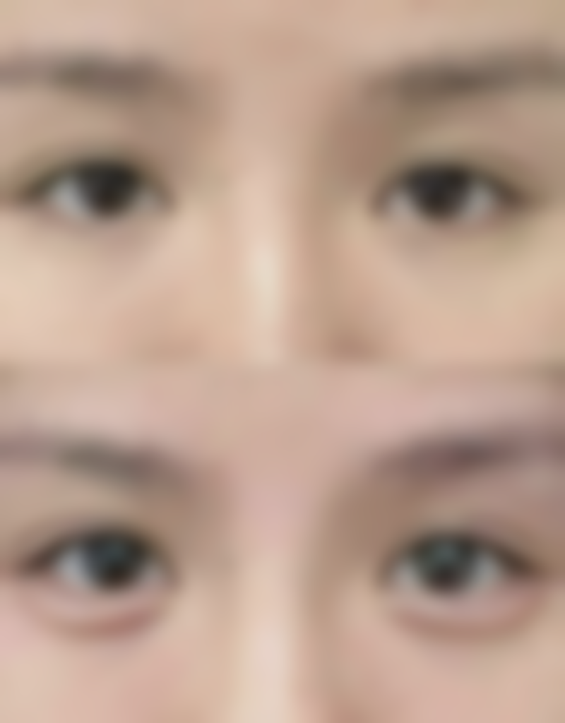 韩国AD爱慕整形外科医院价格表