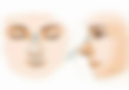 吴少珍医生的技术特点