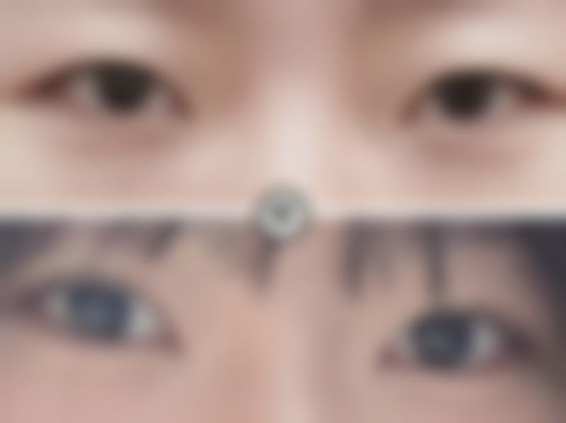 成都悦丽美科口碑怎么样：顾客见证美丽奇迹