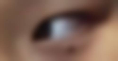 Jackyxu医生技术特点:医学与美学的理想融合