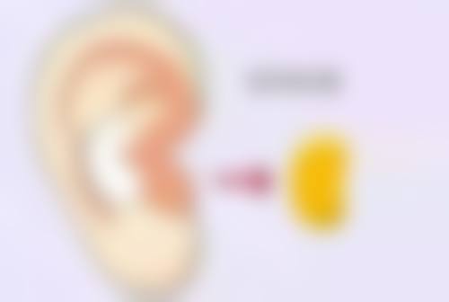 瘦脸针国产衡力能助你轻松拥有精致小脸吗？