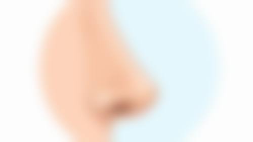 土豆片去除眼睛哭肿后的眼袋适合吗