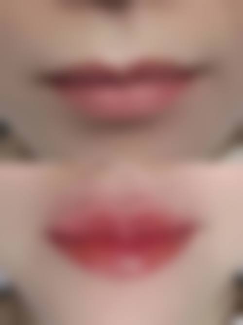 威海可人医疗美容诊所擅长项目：打造专属唇妆秘籍？