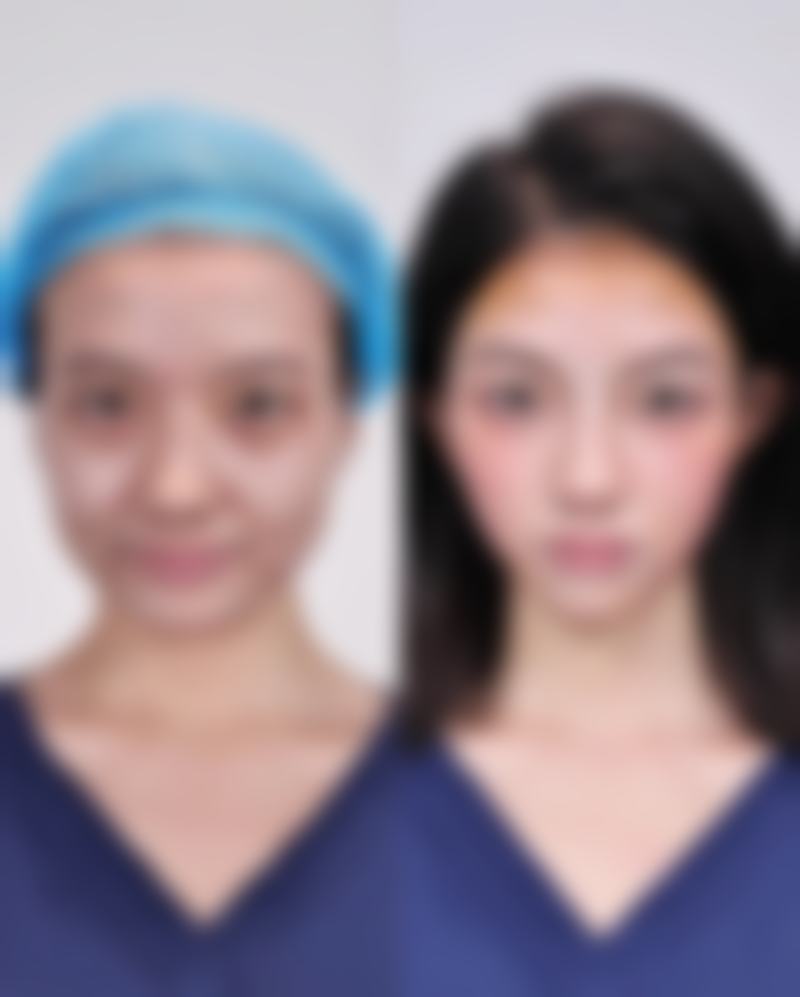 黄小飞医生口碑评价:患者口中的好医生