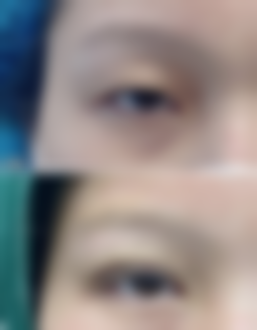 益阳南湖整形医疗美容医院口碑怎么样