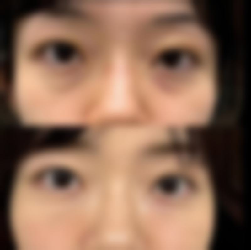 甄琳医师的看诊优势