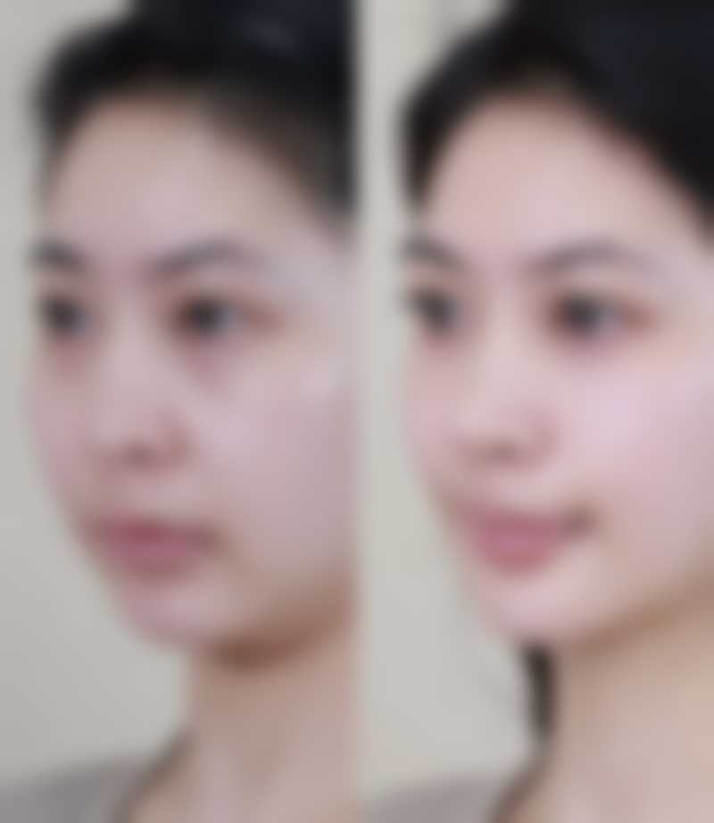 文爱克医生怎么预约挂号