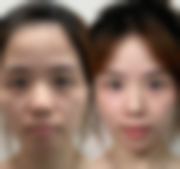 湖北宜昌禧妍医美真实实例