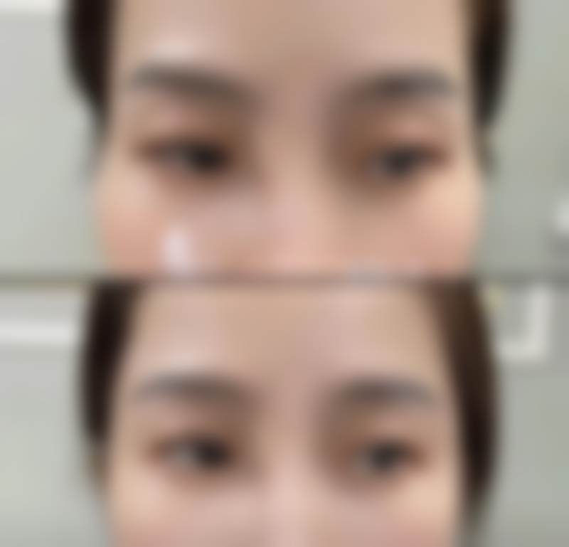 Jackyxu医生擅长项目:艺术面雕与身体塑形的大师