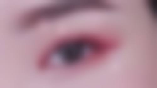 眼角下垂做双眼皮适合所有人吗