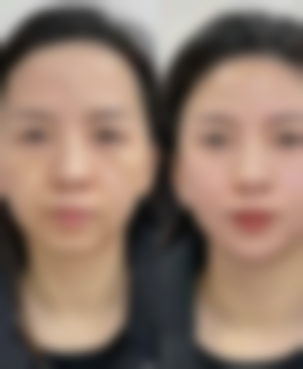 海南金荣美康医疗美容医院擅长项目