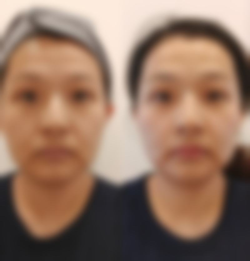 海南金荣美康医疗美容医院价格表