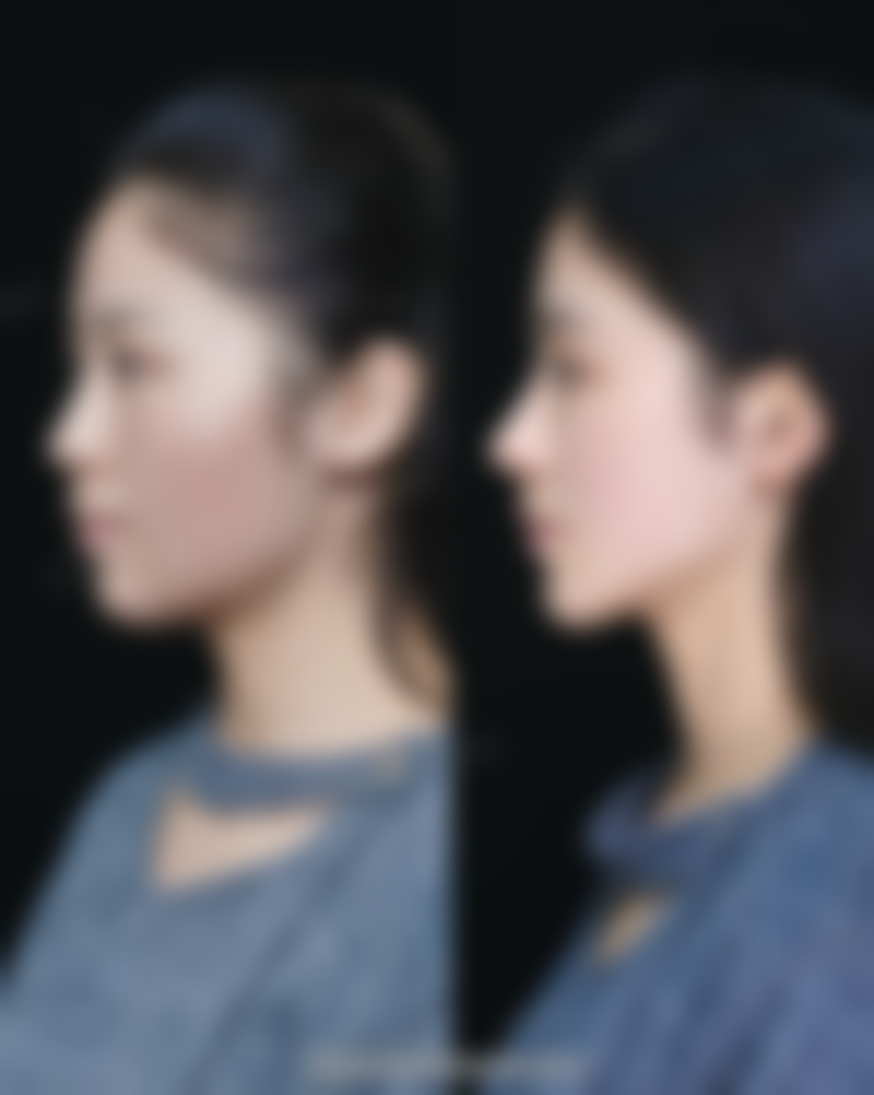 北京世纪晨光医院地址及乘车路线