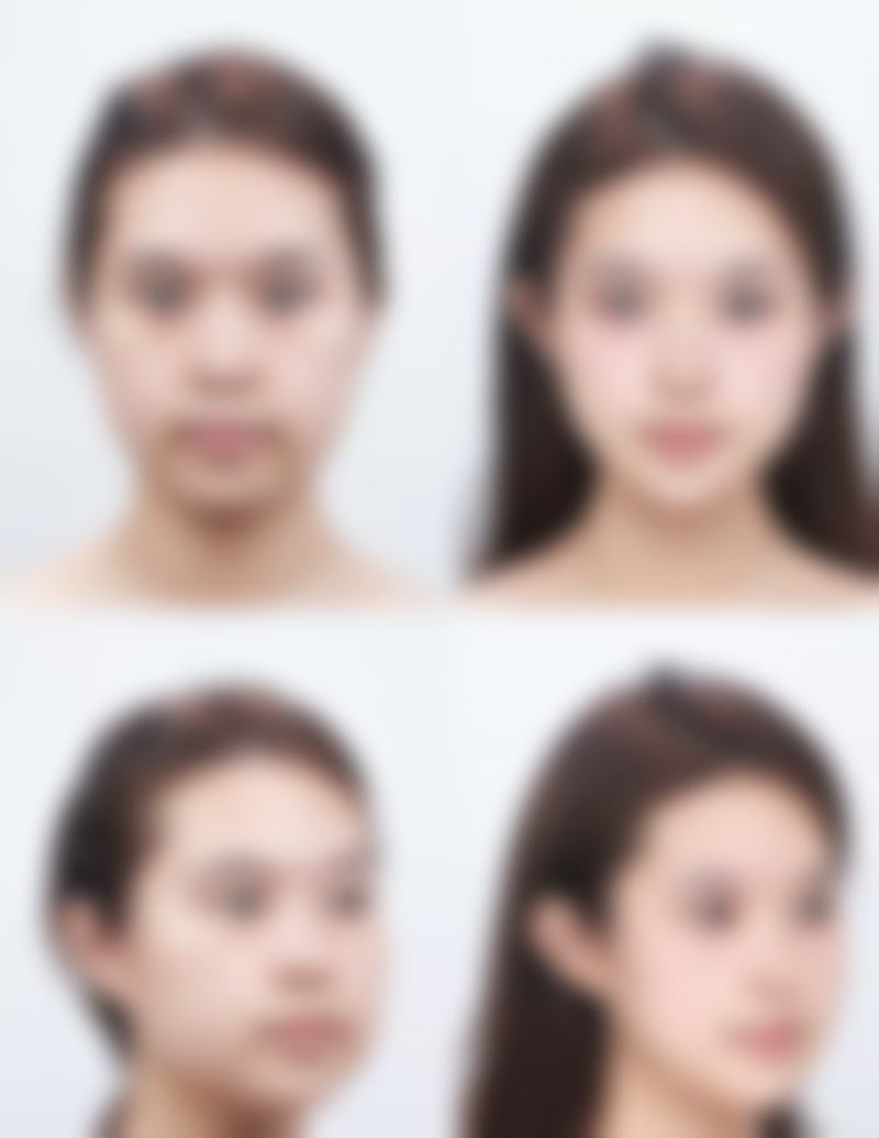 儿童擦伤的疤痕多久会变淡