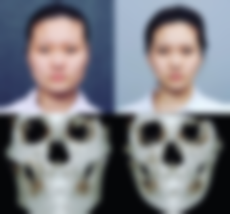 长春工业整形门诊部真实实例：见证变得更美的奇迹