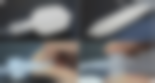 注射隆鼻用羟基磷灰石材料好不好