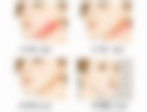 金仁键医生擅长的项目