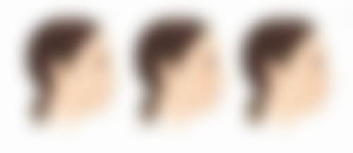 张永香医生真实实例：见证美丽的奇迹时刻