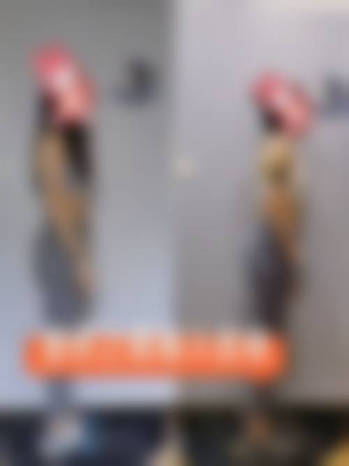 济南捌拾捌空间医疗美容诊所真实实例