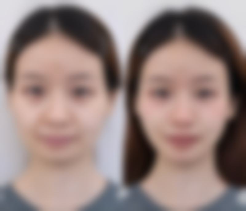 金仁键医生的真实实例