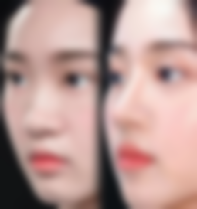 姜亮守院长的技术特点