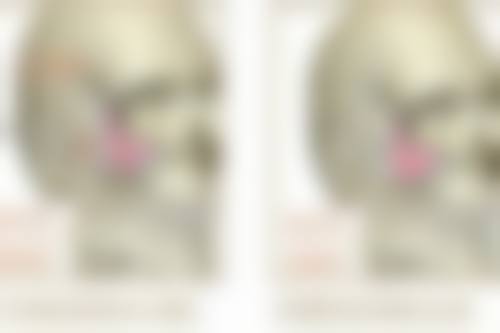 吸脂祛除脂肪眼袋值不值