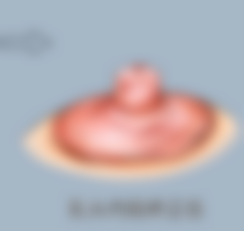 李弦医生技术特点