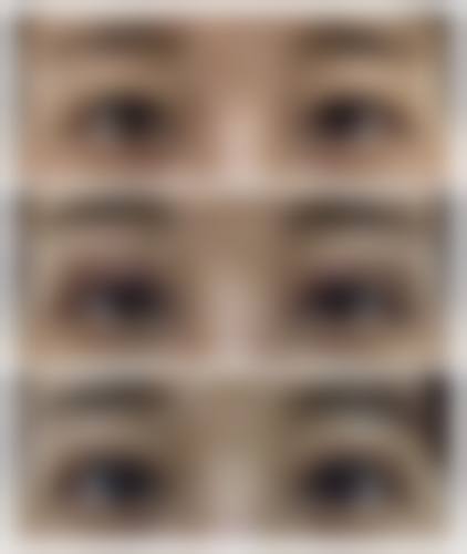 武汉斯启诺医美眼部整形的预约挂号方式