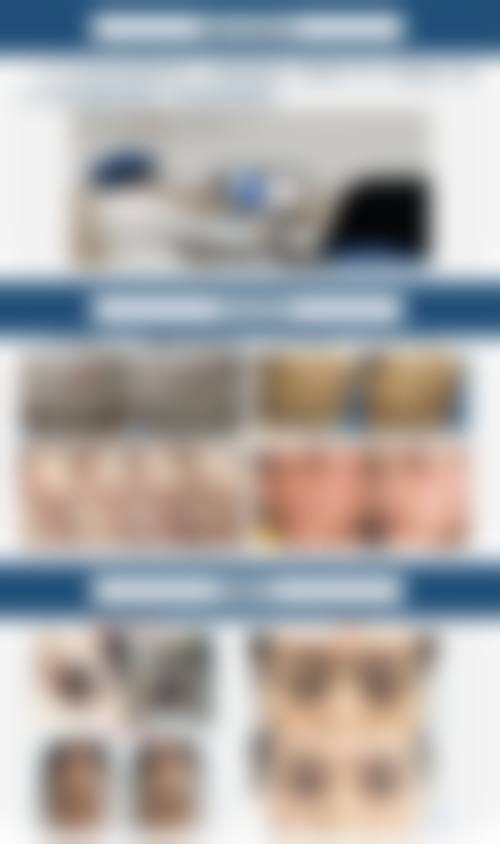 大同三医院整形美容科价格表:性价比极高的变得更美之选