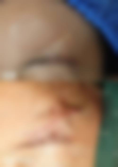 南宁珍善美医疗美容价格表