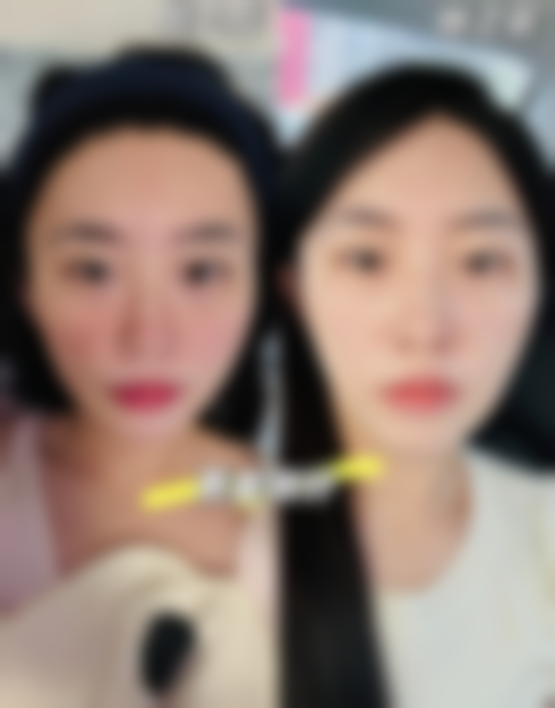 大同三医院整形美容科仪器设备:精良科技,助力变得更美