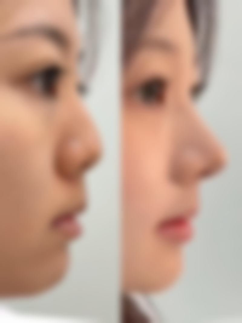 徐州美玲医学整形美容诊所医生名单：专精团队为美护航