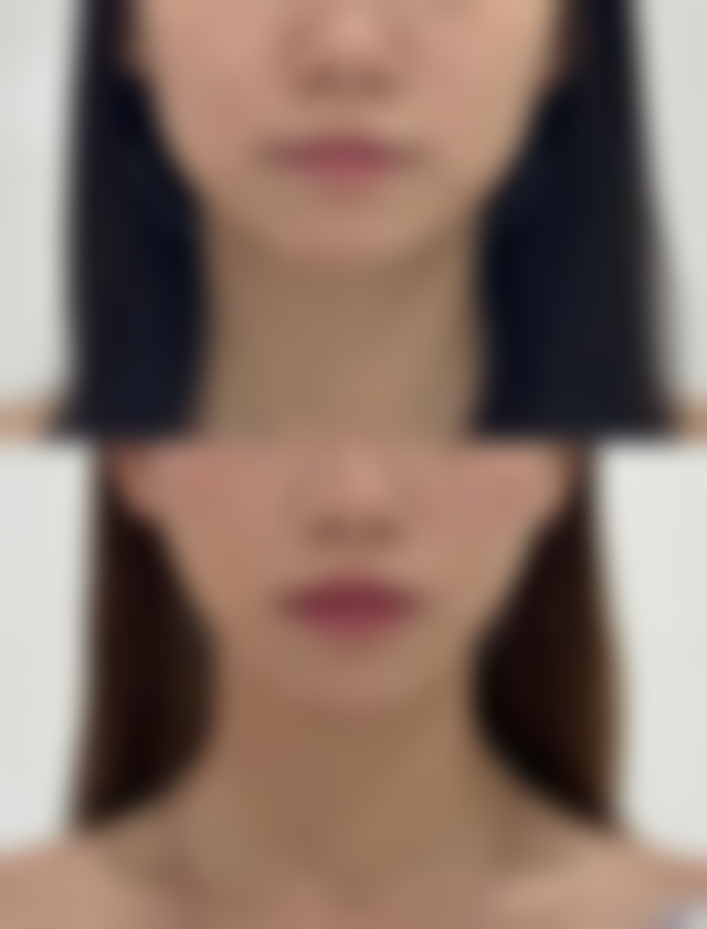 武汉铂晟整形医院地址及乘车路线：轻松抵达美丽殿堂