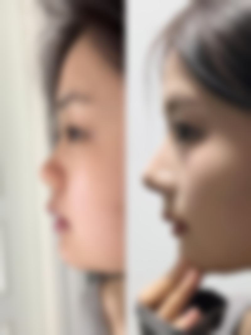 大同三医院整形美容科营业时间:周末也能变得更美啦