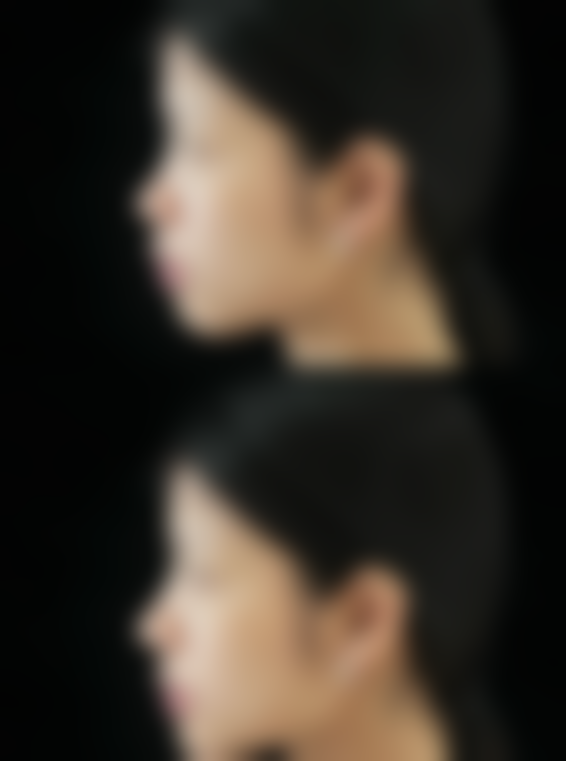 武汉铂晟整形医院预约挂号方式：便捷开启变得更美之旅