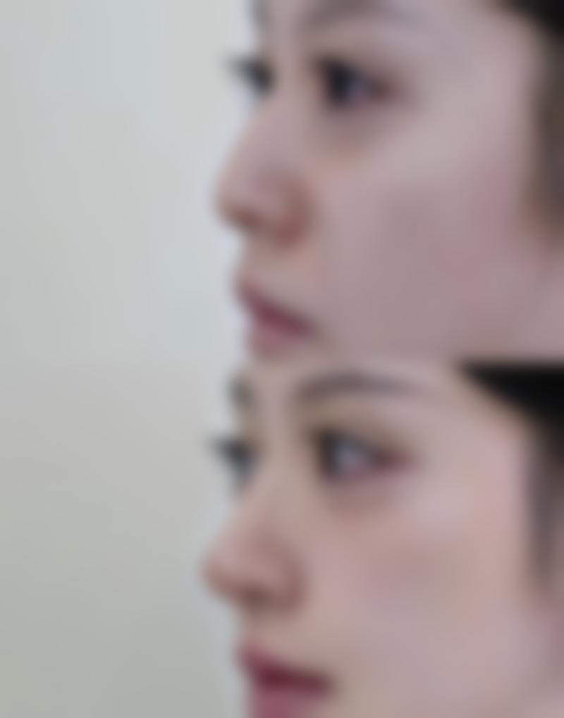 武汉铂晟整形医院口碑怎么样：顾客好评如潮