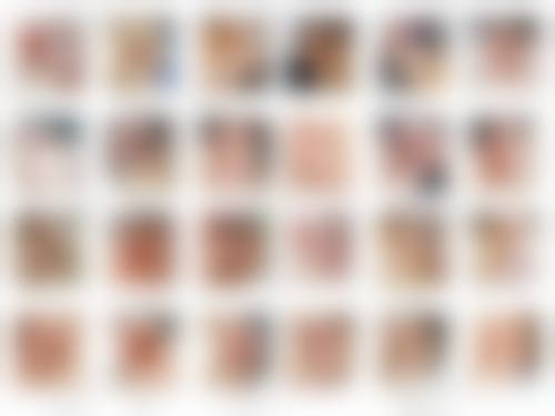 深圳昕美医疗美容诊所真实实例