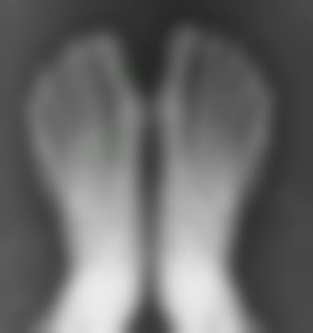 宁波美莱医疗美容医院价格表