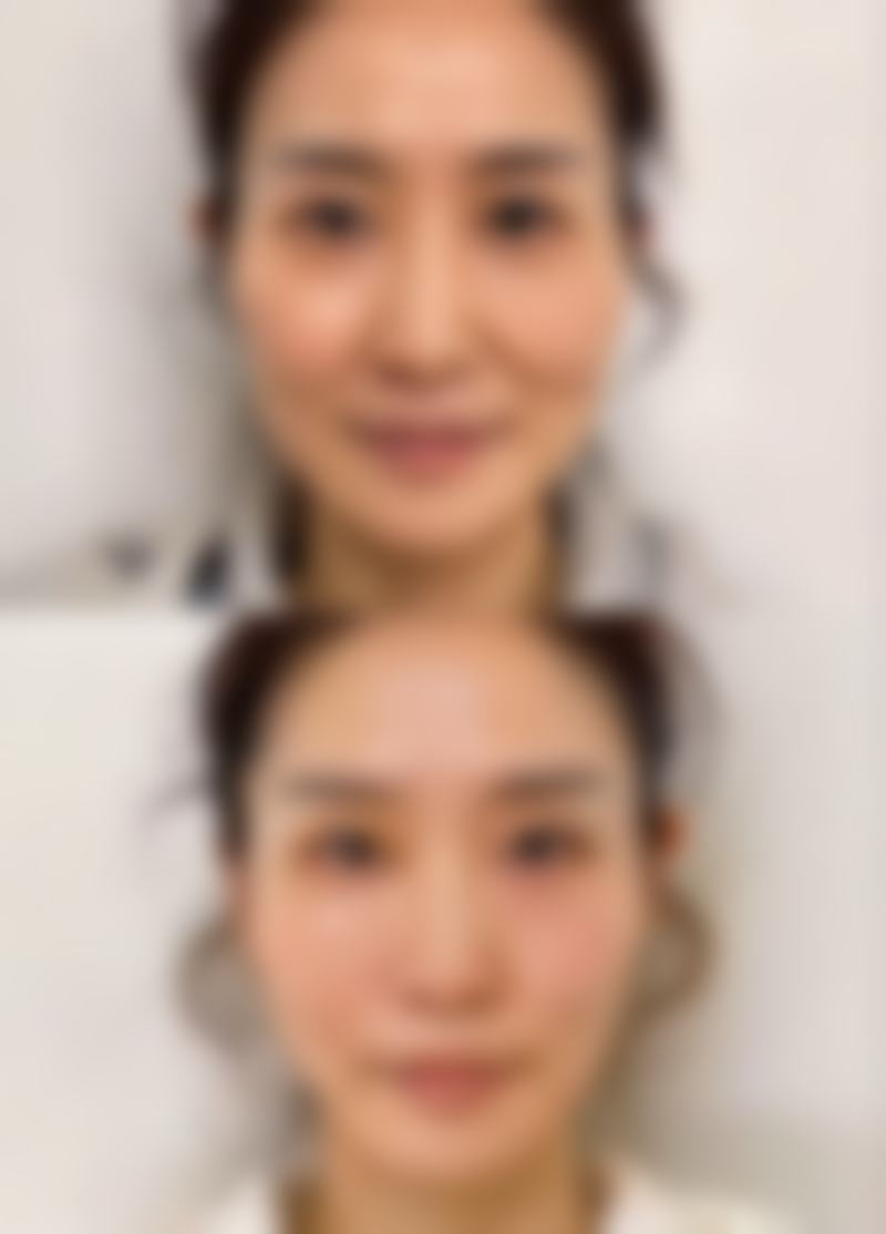 崔贤镒医生口碑评价