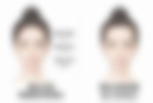 激光治疗疤痕里面硬值不值