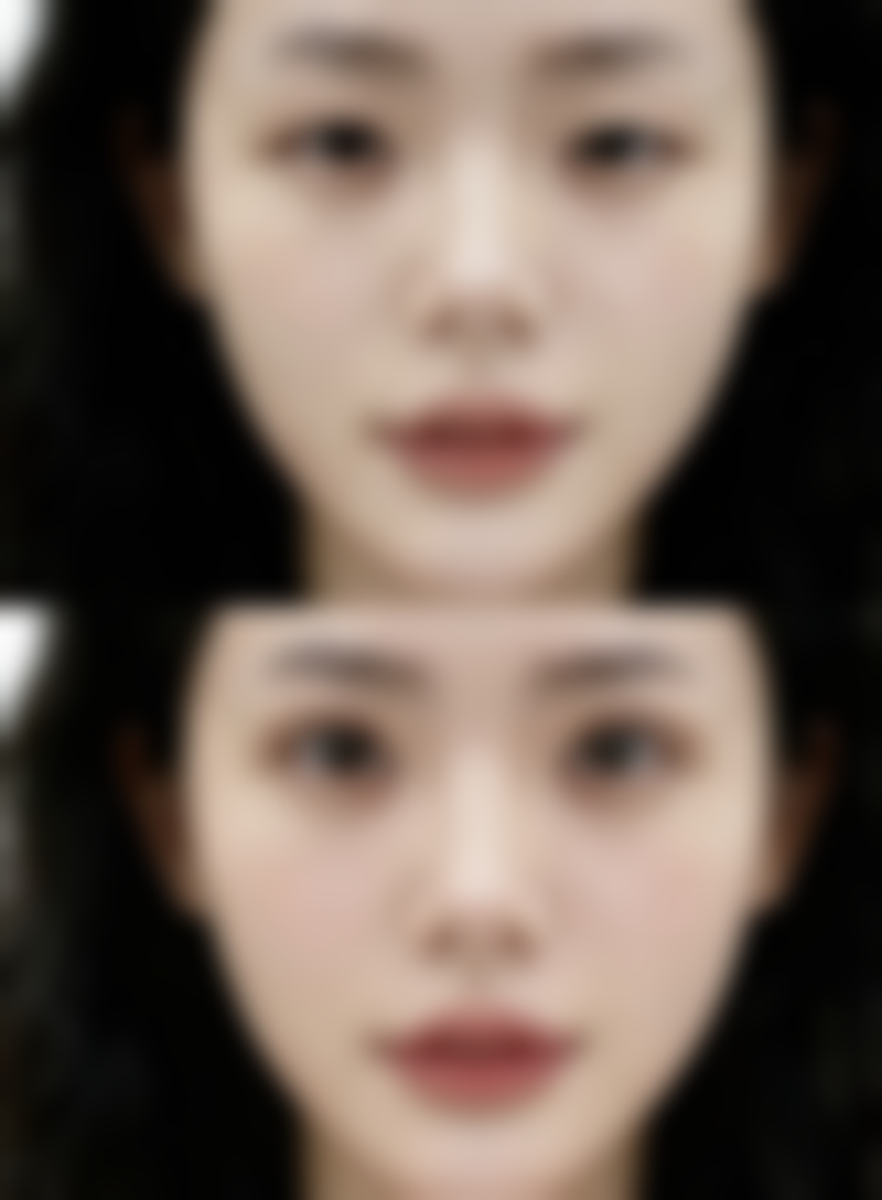 如何判断双眼皮拆线后是否可以化眼妆