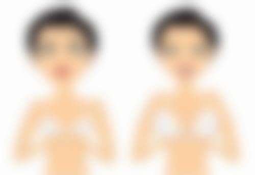 隆鼻后鼻头红点一直不消是过敏了吗