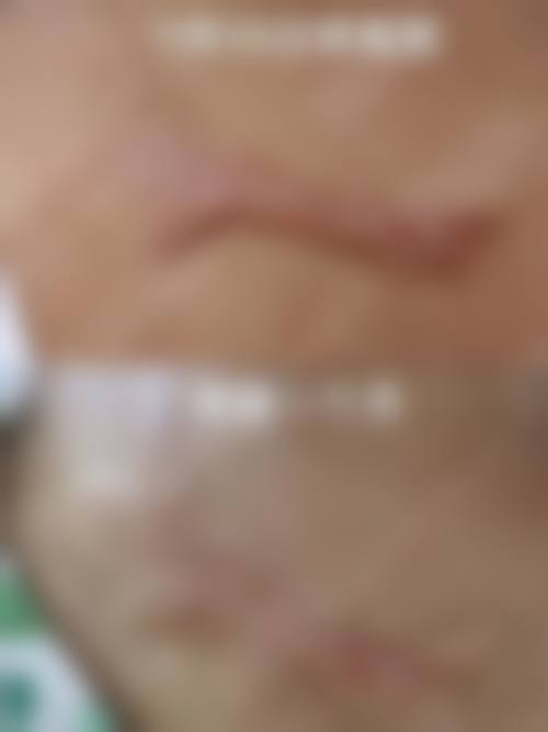 遇见美整形医院执业信息：正规可靠的变得更美保护