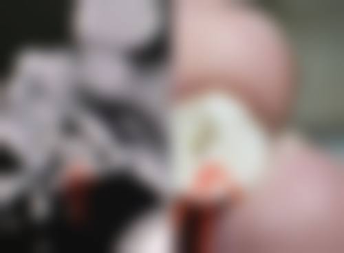 广西壮族自治区肿 瘤医院整形科价格表