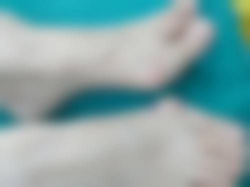 杭州韩美整形价格表:透明合理有优惠