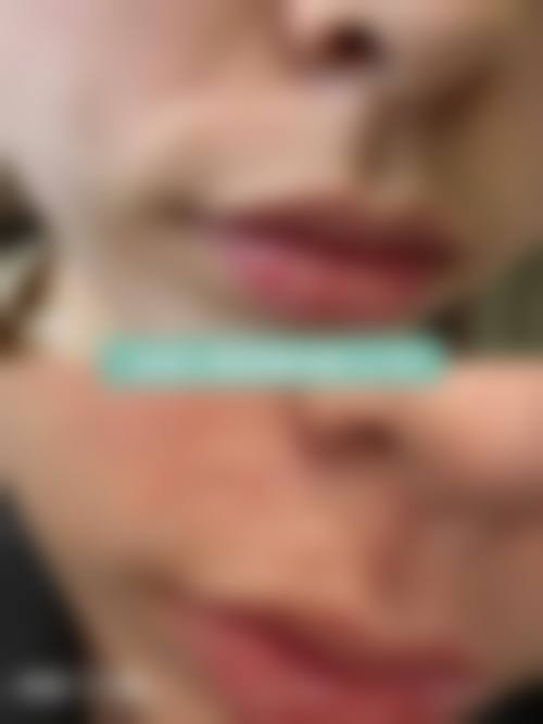 保山阳光医院医学整形科医生名单