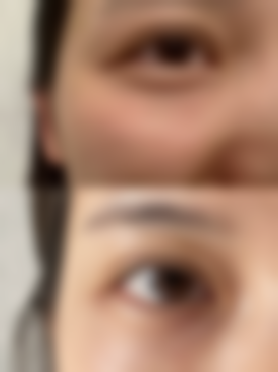 大连易美佳整形医疗美容门诊价格表