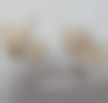 溶脂去眼袋的费用大概是多少